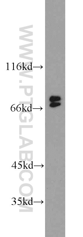 Raji cells were subjected to SDS PAGE followed by western blot with 10855-1-AP(BLNK Antibody) at dilution of 1:300 BLNK western blot WB 10855-1-AP BLNK Antibody BASH; BLNK-S; LY57; MGC111051; SLP-65; SLP65