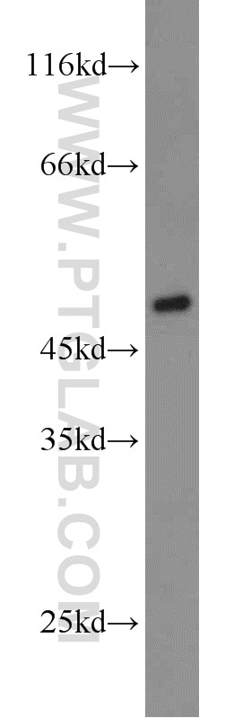 BMP15 western blot WB 18982-1-AP BMP15 Antibody GDF9B; ODG2; POF4