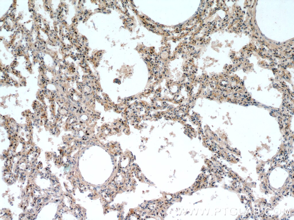 BMP4 IHC Immunohistochemical 12492-1-AP BMP4 Antibody BMP2B; BMP2B1; MCOPS6; ZYME