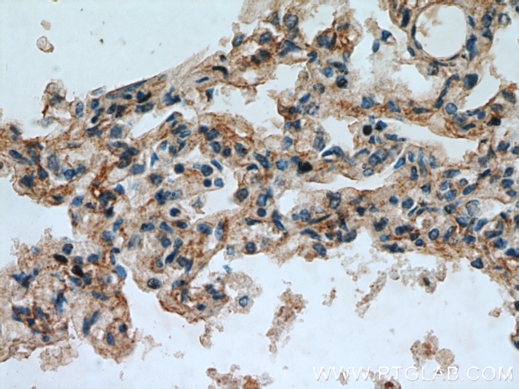 BMP4 IHC Immunohistochemical 12492-1-AP BMP4 Antibody BMP2B; BMP2B1; MCOPS6; ZYME