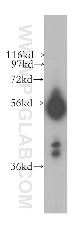 BMP4 western blot WB 12492-1-AP BMP4 Antibody BMP2B; BMP2B1; MCOPS6; ZYME