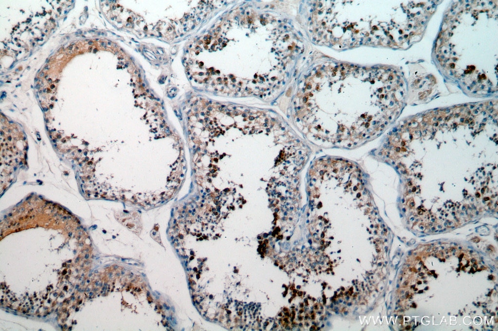 BOLL IHC Immunohistochemical 13720-1-AP BOLL Antibody 
