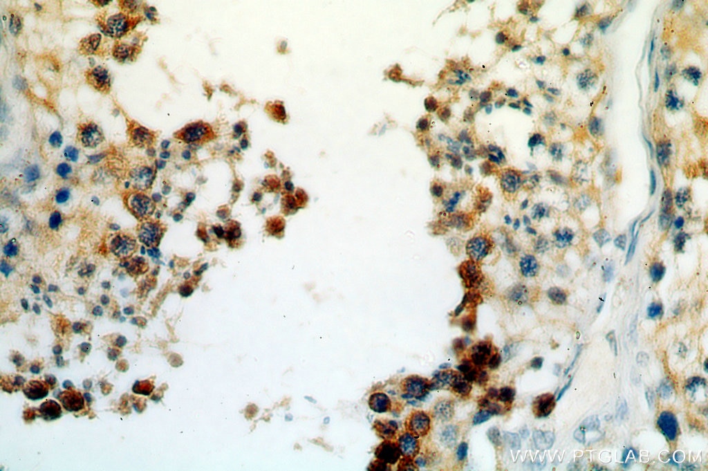 BOLL IHC Immunohistochemical 13720-1-AP BOLL Antibody 