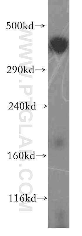 human brain tissue were subjected to SDS PAGE followed by western blot with 19791-1-AP(BRCA2 Antibody) at dilution of 1:300 BRCA2 western blot WB 19791-1-AP BRCA2 Antibody BRCC2; BROVCA2; FACD; FAD; FAD1; FANCB; FANCD; FANCD1