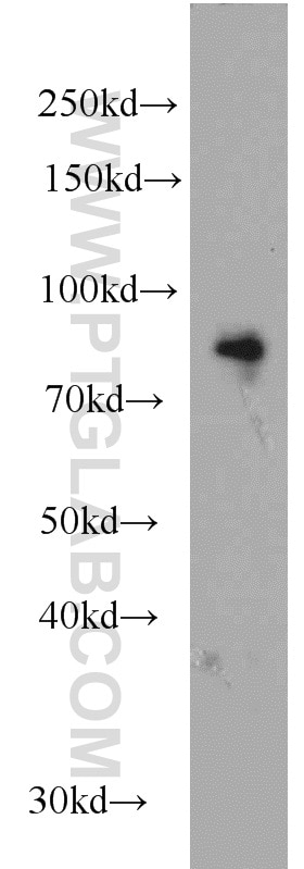 mouse brain tissue were subjected to SDS PAGE followed by western blot with 12673-1-AP(BRSK1 Antibody) at dilution of 1:500 BRSK1 western blot WB 12673-1-AP BRSK1 Antibody FLJ43009; KIAA1811