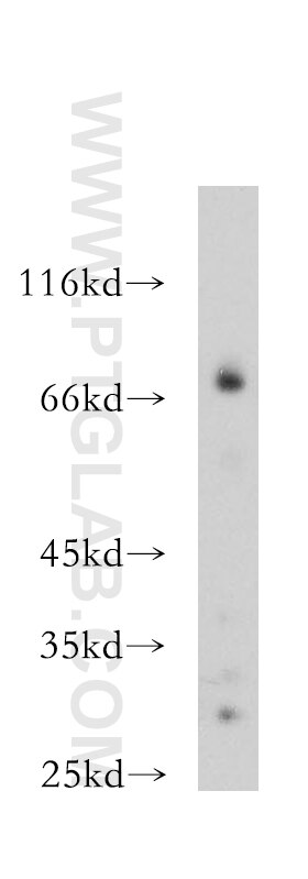 mouse skeletal muscle tissue were subjected to SDS PAGE followed by western blot with 12920-1-AP(BVES Antibody) at dilution of 1:800 BVES western blot WB 12920-1-AP BVES Antibody HBVES; MGC42413; POP1; POPDC1