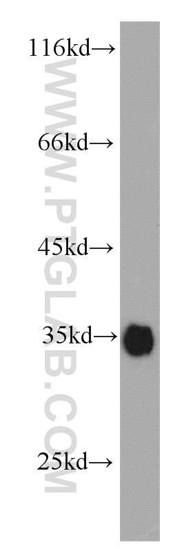 Bcl-xL western blot WB 10783-1-AP Bcl-xL Antibody BCL-XL/S; BCL2L; BCLX; Bcl-X; DKFZp781P2092; bcl-xL; bcl-xS