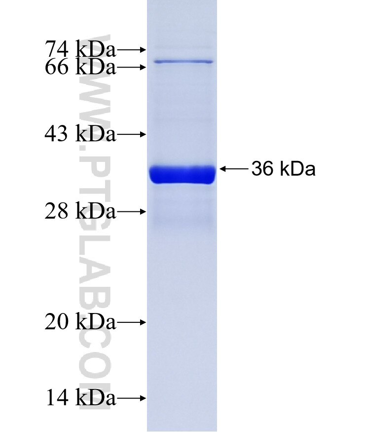 C7orf23 fusion protein ag14979 SDS-PAGE