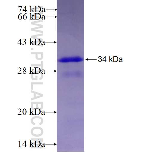 CA4 fusion protein ag5449 SDS-PAGE