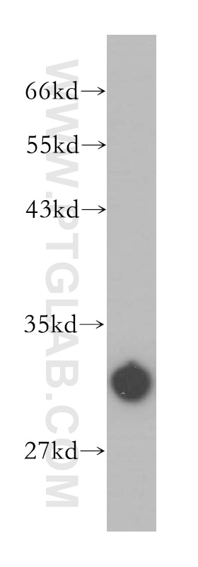 mouse testis tissue were subjected to SDS PAGE followed by western blot with 13342-1-AP(CA5B Antibody) at dilution of 1:1200 CA5B western blot WB 13342-1-AP CA5B Antibody CA-VB; MGC39962