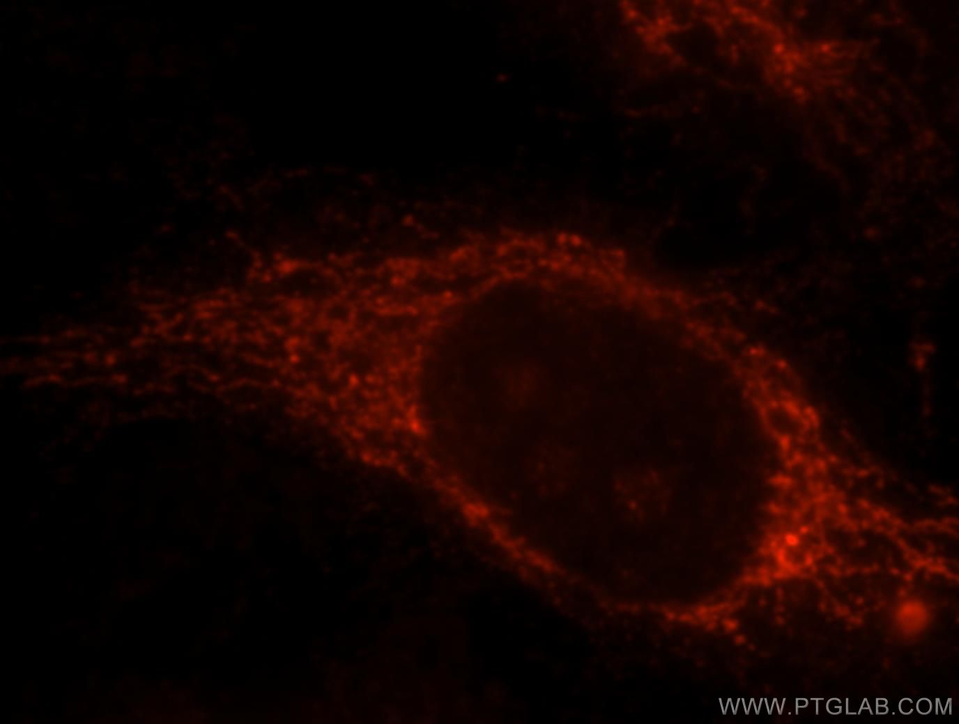 CABC1 Immunofluorescence IF 15528-1-AP CABC1 Antibody ADCK3; ARCA2; COQ8; MGC4849; SCAR9