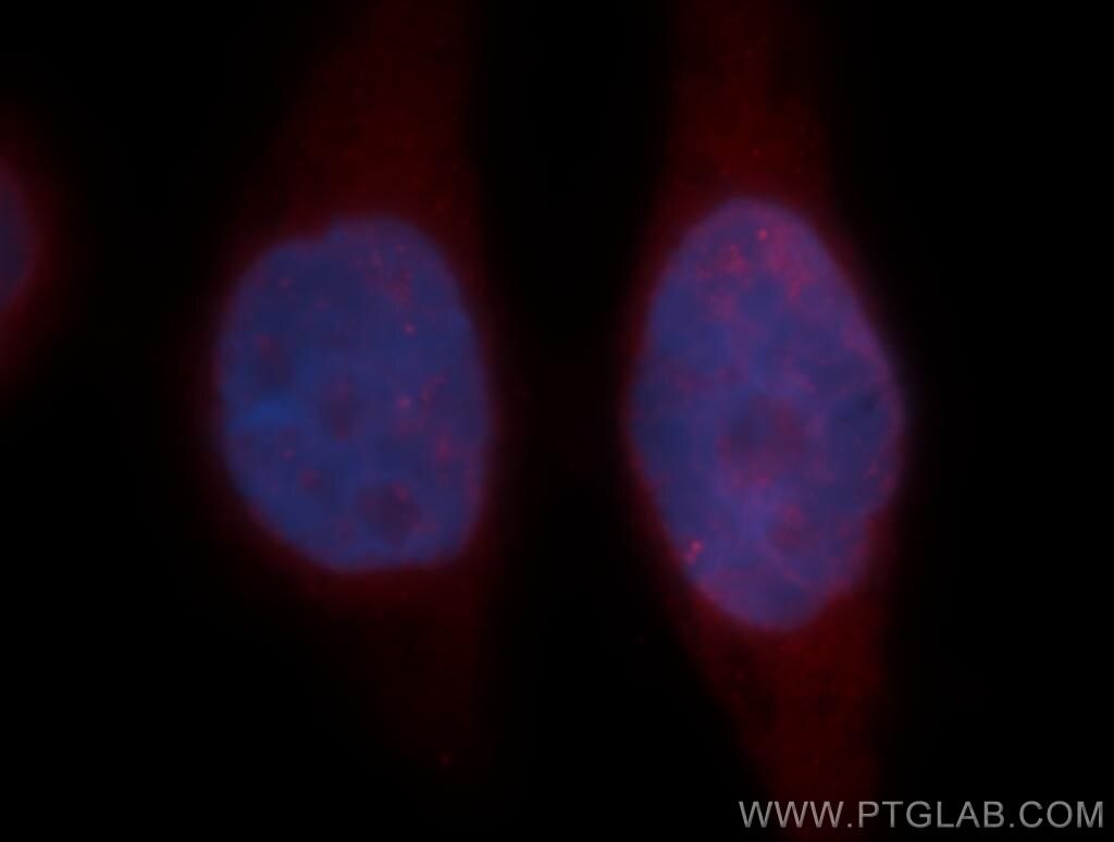 CALM3 Immunofluorescence IF 10112-1-AP CALM3 Antibody PHKD; PHKD3