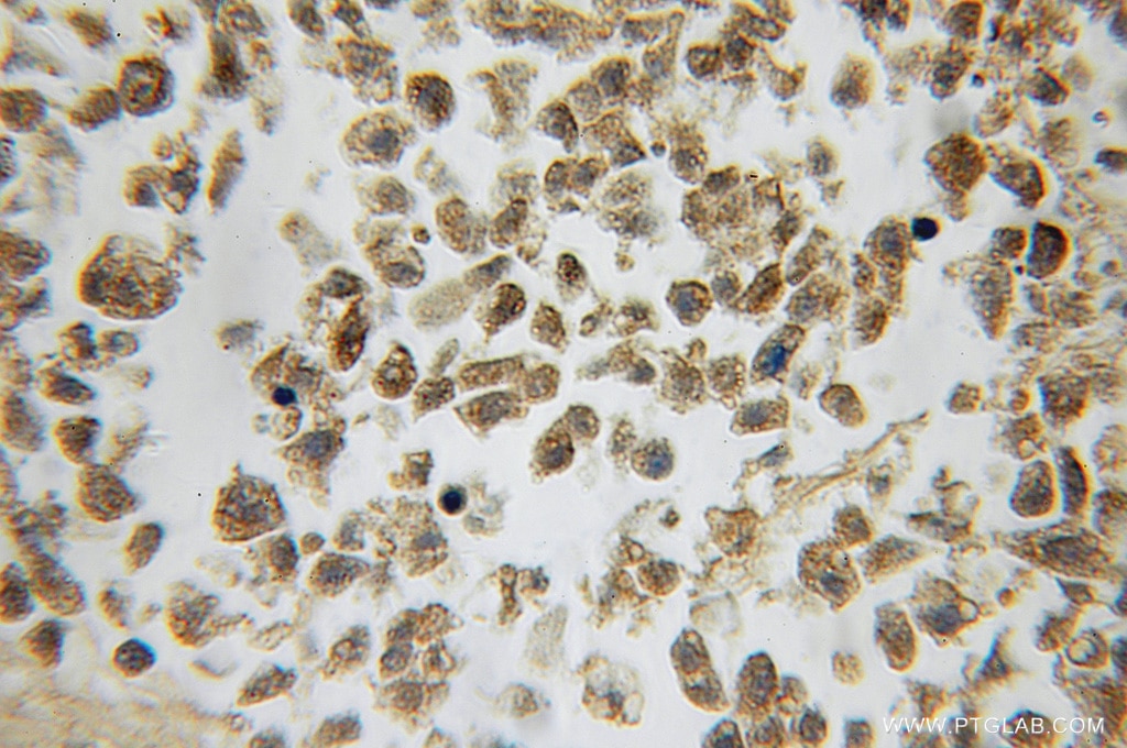CALM3 IHC Immunohistochemical 10112-1-AP CALM3 Antibody PHKD; PHKD3