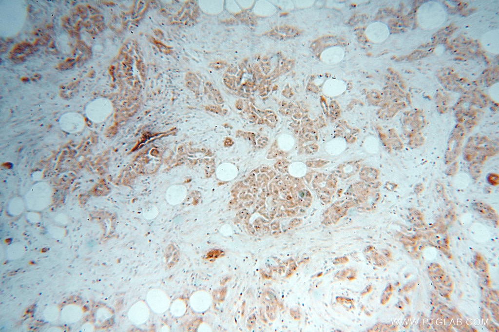 CALM3 IHC Immunohistochemical 10541-1-AP CALM3 Antibody PHKD; PHKD3