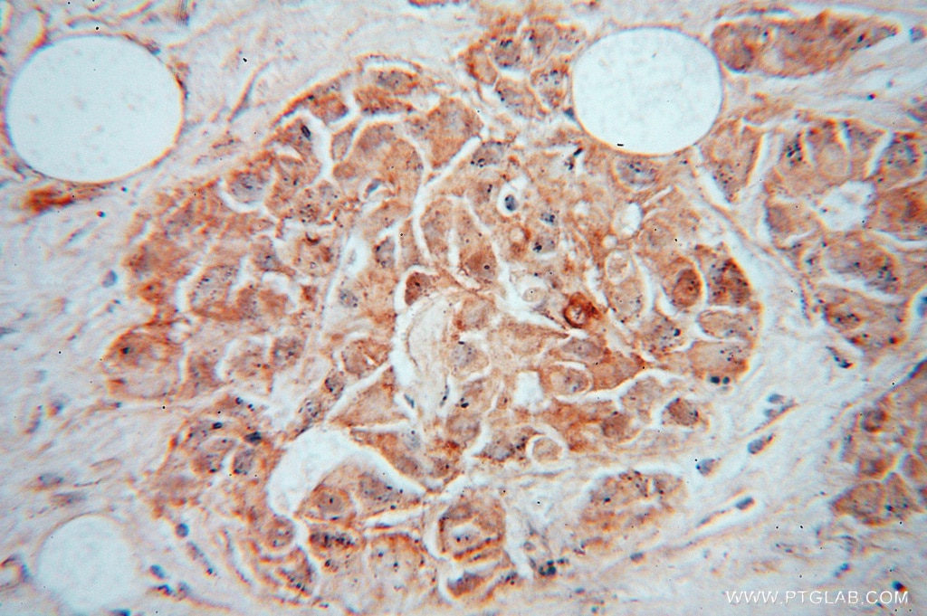 CALM3 IHC Immunohistochemical 10541-1-AP CALM3 Antibody PHKD; PHKD3
