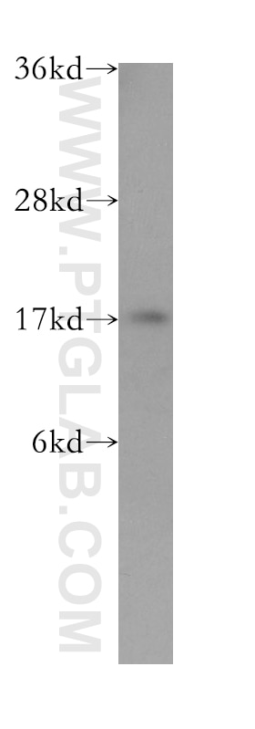 CALM3 western blot WB 10541-1-AP CALM3 Antibody PHKD; PHKD3