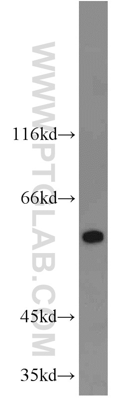 COLO 320 cells were subjected to SDS PAGE followed by western blot with 10292-1-AP(calreticulin Antibody) at dilution of 1:600 calreticulin western blot WB 10292-1-AP calreticulin Antibody CRT; FLJ26680; RO; SSA; cC1qR