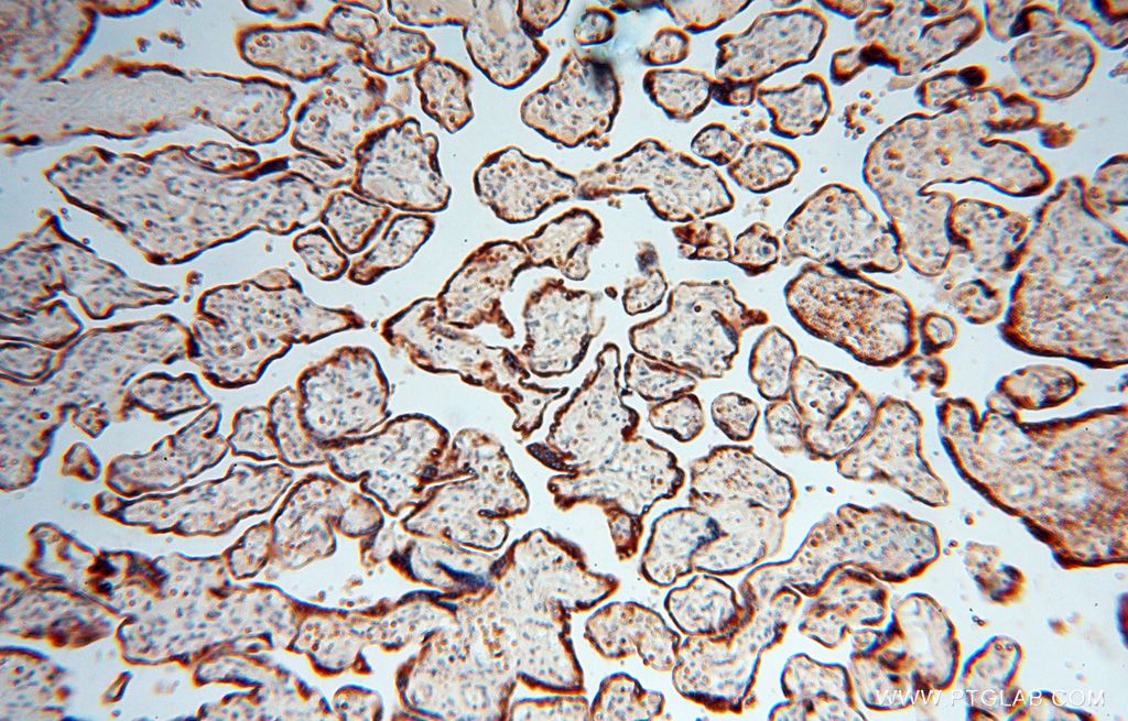 CALU IHC Immunohistochemical 17804-1-AP CALU Antibody FLJ90608