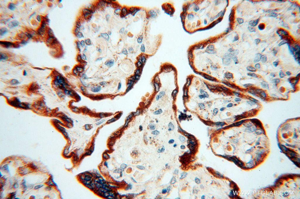 CALU IHC Immunohistochemical 17804-1-AP CALU Antibody FLJ90608