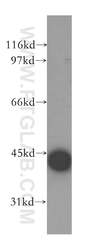 mouse thymus tissue were subjected to SDS PAGE followed by western blot with 13613-1-AP(CAMK1D Antibody) at dilution of 1:2000 CAMK1D western blot WB 13613-1-AP CAMK1D Antibody CKLiK; CaM-K1; CaMKID