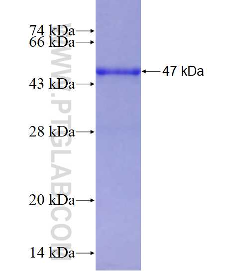 CAMK1D fusion protein ag4517 SDS-PAGE