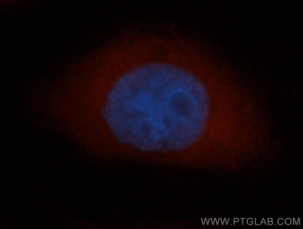 CAPG Immunofluorescence IF 10194-1-AP CAPG Antibody AFCP; MCP