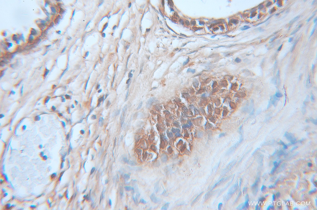 CAPG IHC Immunohistochemical 10194-1-AP CAPG Antibody AFCP; MCP