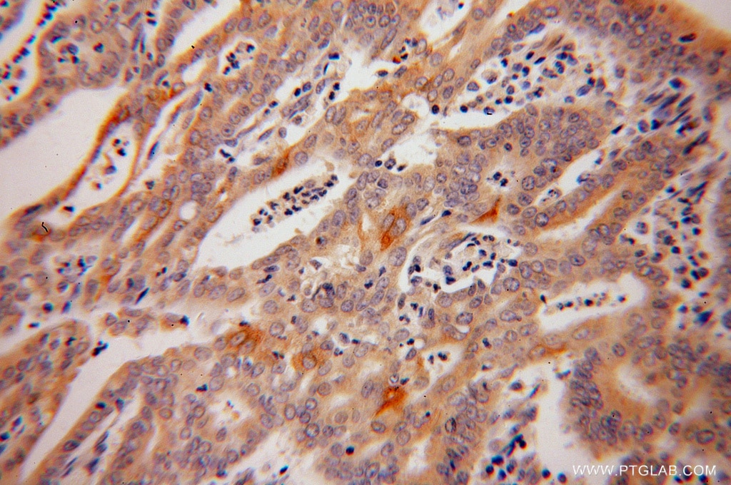 CASP10 IHC Immunohistochemical 14311-1-AP CASP10 Antibody ALPS2; FLICE2; MCH4
