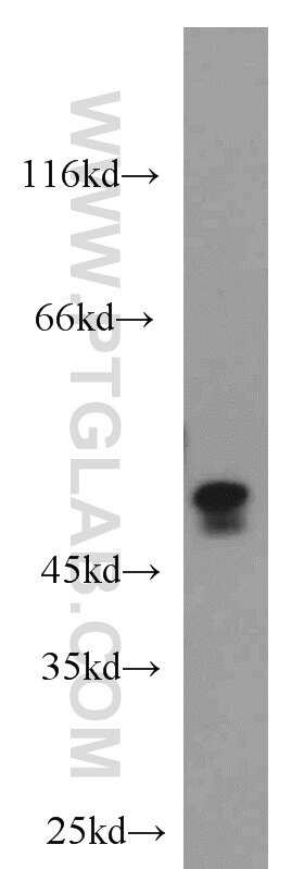 CASP2 western blot WB 10436-1-AP CASP2 Antibody CASP-2; ICH-1L; ICH-1L/1S; ICH1; NEDD2