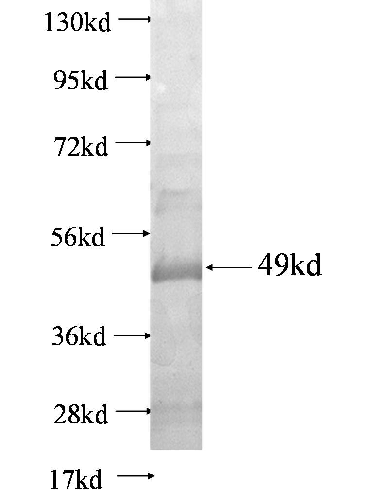 CASP2 fusion protein ag0694 SDS-PAGE