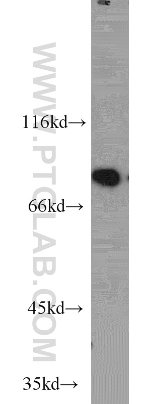 CBP80 western blot WB 10349-1-AP CBP80 Antibody CBP80; MGC2087; NCBP