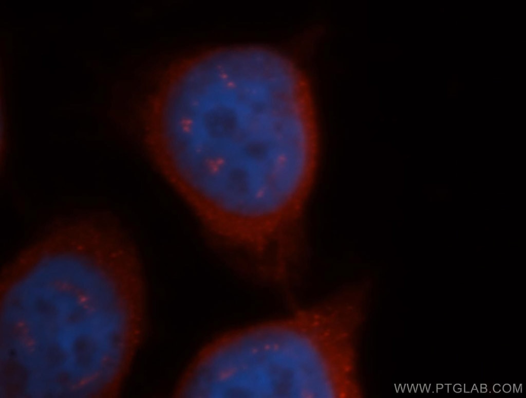 CBS Immunofluorescence IF 14787-1-AP CBS Antibody HIP4