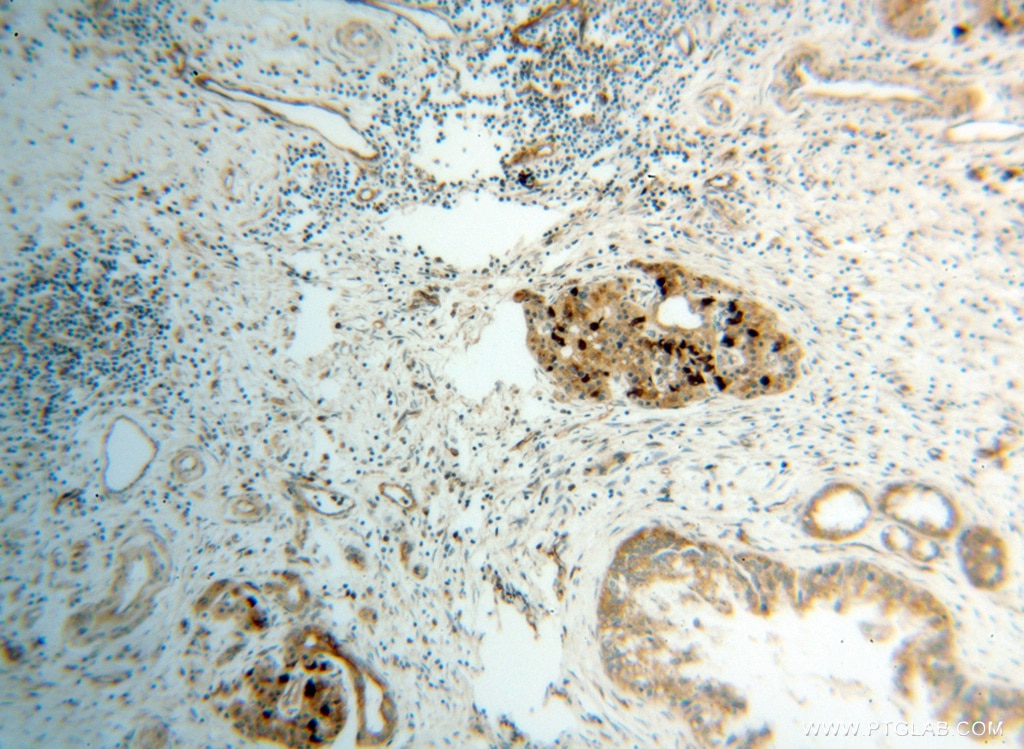 CBS IHC Immunohistochemical 14787-1-AP CBS Antibody HIP4