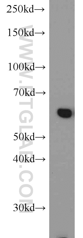 CBS western blot WB 14787-1-AP CBS Antibody HIP4