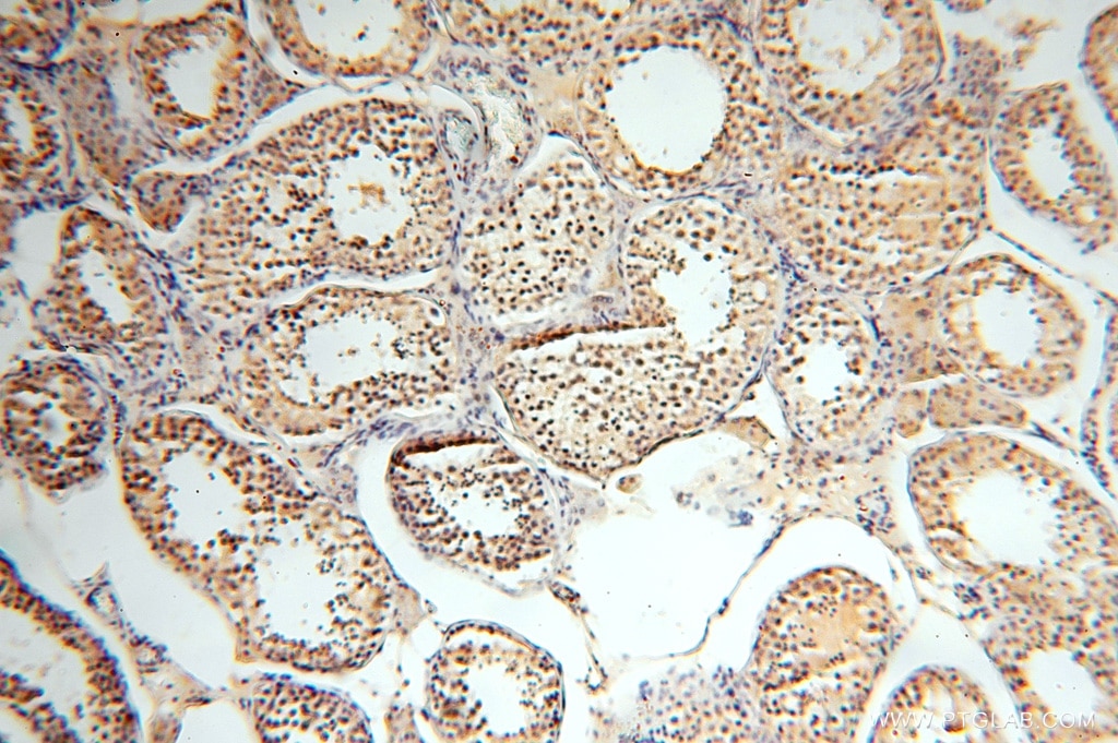 CC2D1A IHC Immunohistochemical 16816-1-AP CC2D1A Antibody FLJ20241; FLJ41160; FREUD-1; Freud-1/Aki1; MRT3