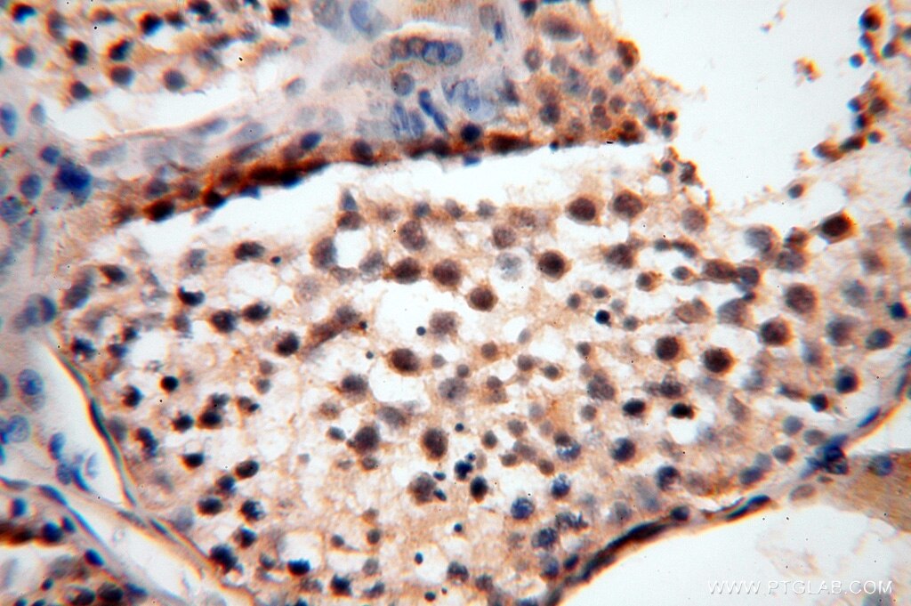 CC2D1A IHC Immunohistochemical 16816-1-AP CC2D1A Antibody FLJ20241; FLJ41160; FREUD-1; Freud-1/Aki1; MRT3