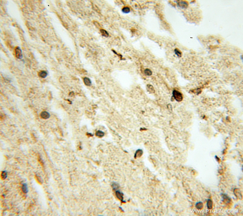 CCND2 IHC Immunohistochemical 10934-1-AP CCND2 Antibody KIAK0002; MGC102758