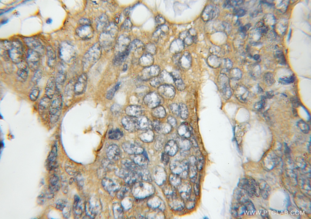 CCT5 IHC Immunohistochemical 11603-1-AP CCT5 Antibody CCT-epsilon; CCTE; KIAA0098; TCP-1-epsilon
