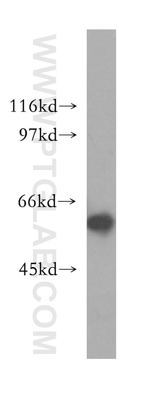 CCT5 western blot WB 11603-1-AP CCT5 Antibody CCT-epsilon; CCTE; KIAA0098; TCP-1-epsilon