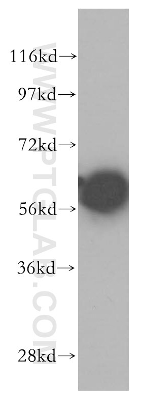 CCT8 western blot WB 12263-1-AP CCT8 Antibody C21orf112; Cctq; D21S246; KIAA0002; PRED71
