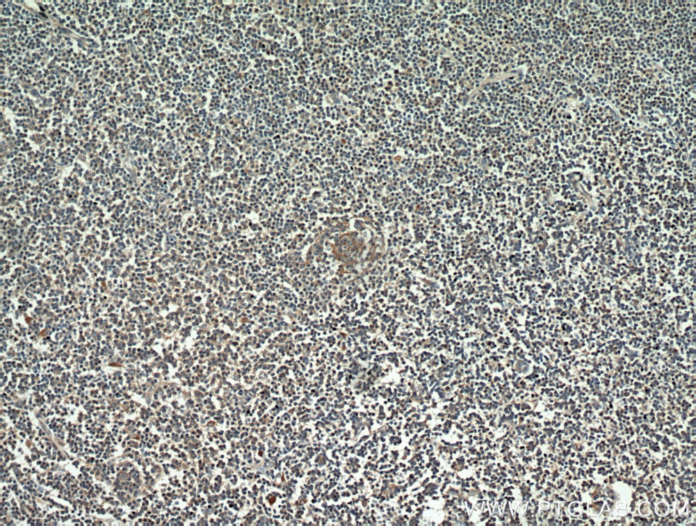 CD23,FCER2 IHC Immunohistochemical 60208-1-Ig CD23,FCER2 Antibody CD23; CD23A; CLEC4J; FCE2; IGEBF