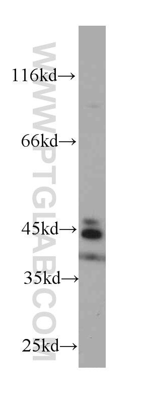 CD23,FCER2 western blot WB 60208-1-Ig CD23,FCER2 Antibody CD23; CD23A; CLEC4J; FCE2; IGEBF