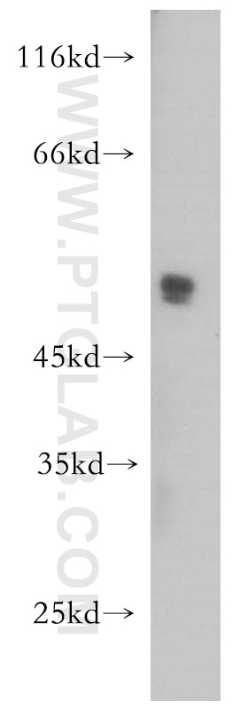 MCF7 cells were subjected to SDS PAGE followed by western blot with 18330-1-AP(CD24 Antibody) at dilution of 1:1000 CD24 western blot WB 18330-1-AP CD24 Antibody CD24A; FLJ22950; FLJ43543; MGC75043