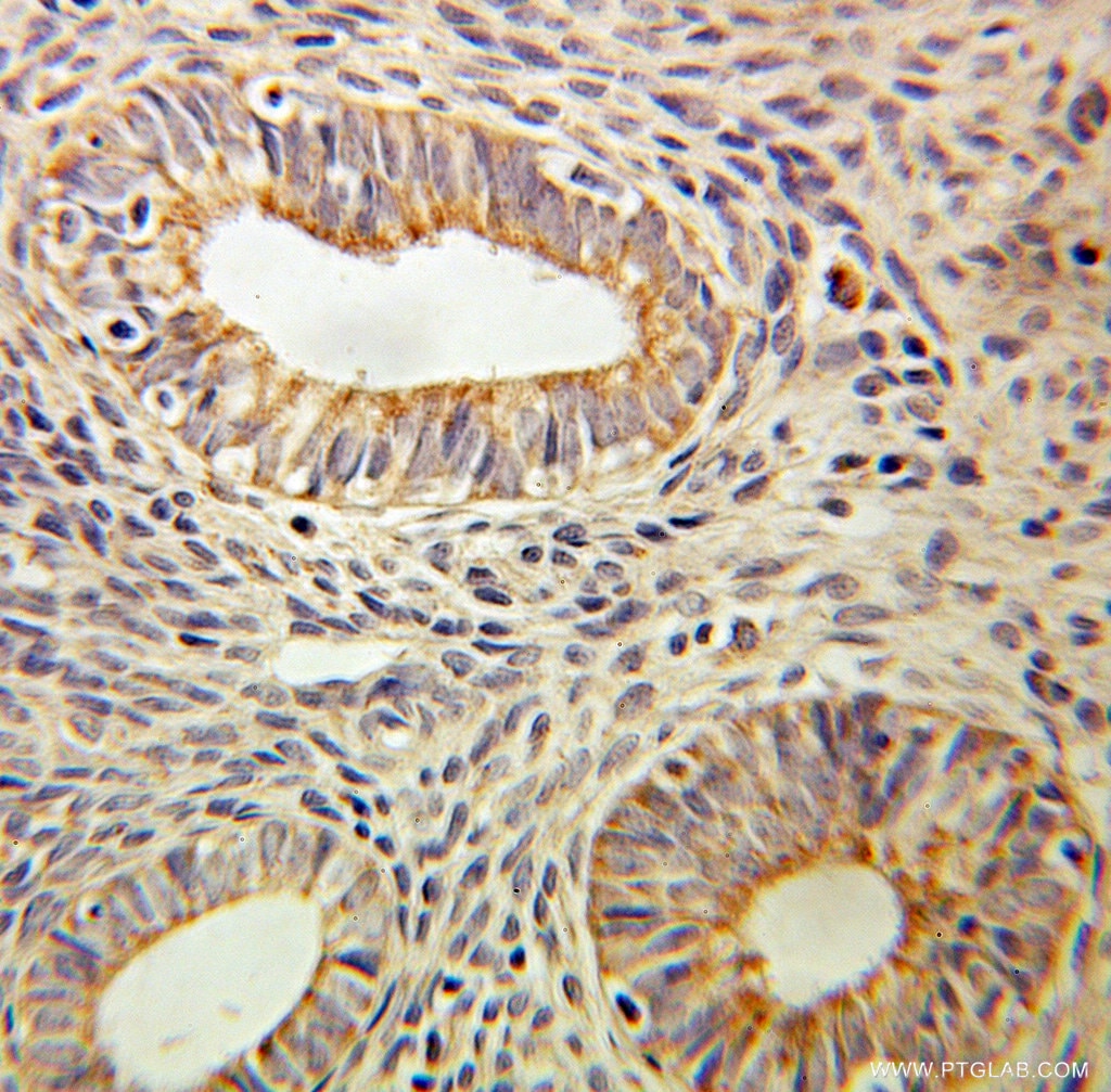 CD59 IHC Immunohistochemical 10742-1-AP CD59 Antibody 16.3A5; 1F5; EJ16; EJ30; EL32; FLJ38134; FLJ92039; G344; HRF-20; HRF20; MAC-IP; MACIF; MEM43; MGC2354; MIC11; MIN1; MIN2; MIN3; MIRL; MSK21; p18-20