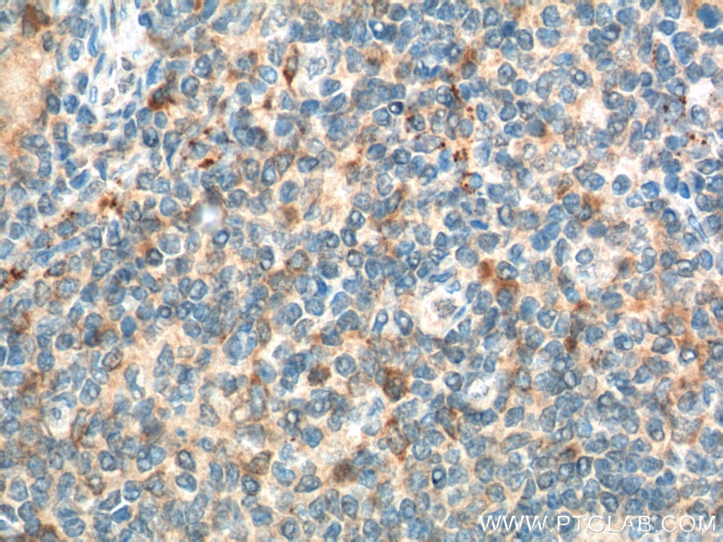 PTGLab CD86 Antibody 133951AP