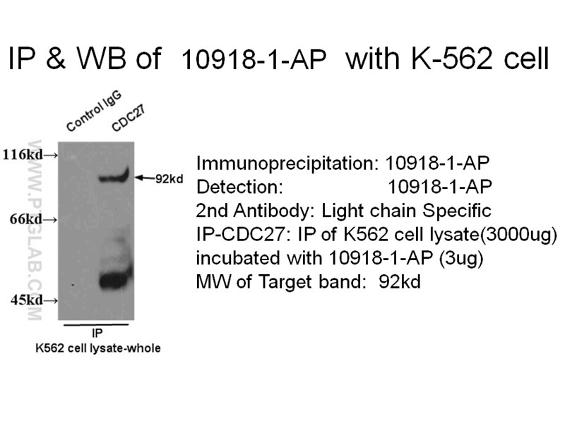 CDC27; APC3 IP 10918-1-AP CDC27; APC3 Antibody APC3; CDC27Hs; D0S1430E; D17S978E; HNUC