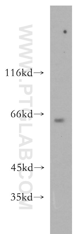 CDC2L6 western blot WB 13761-1-AP CDC2L6 Antibody CDK11; KIAA1028; bA346C16.3
