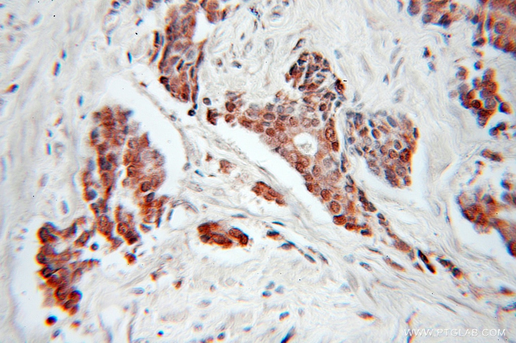CDC34 IHC Immunohistochemical 10964-2-AP CDC34 Antibody E2-CDC34; UBC3; UBE2R1