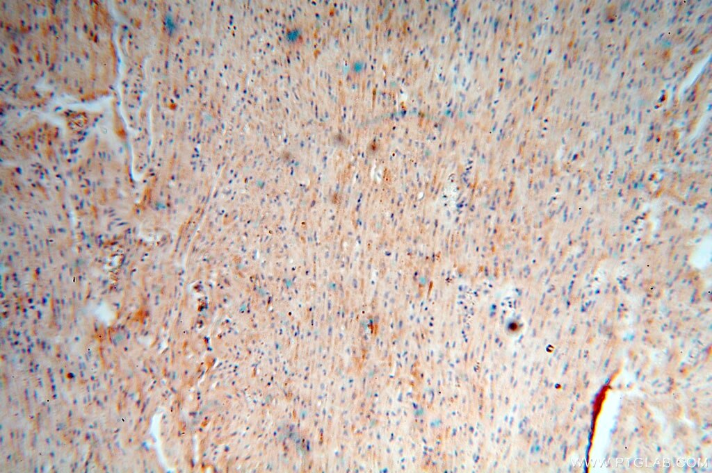 CDC37L1 IHC Immunohistochemical 16293-1-AP CDC37L1 Antibody CDC37B; FLJ20639; HARC