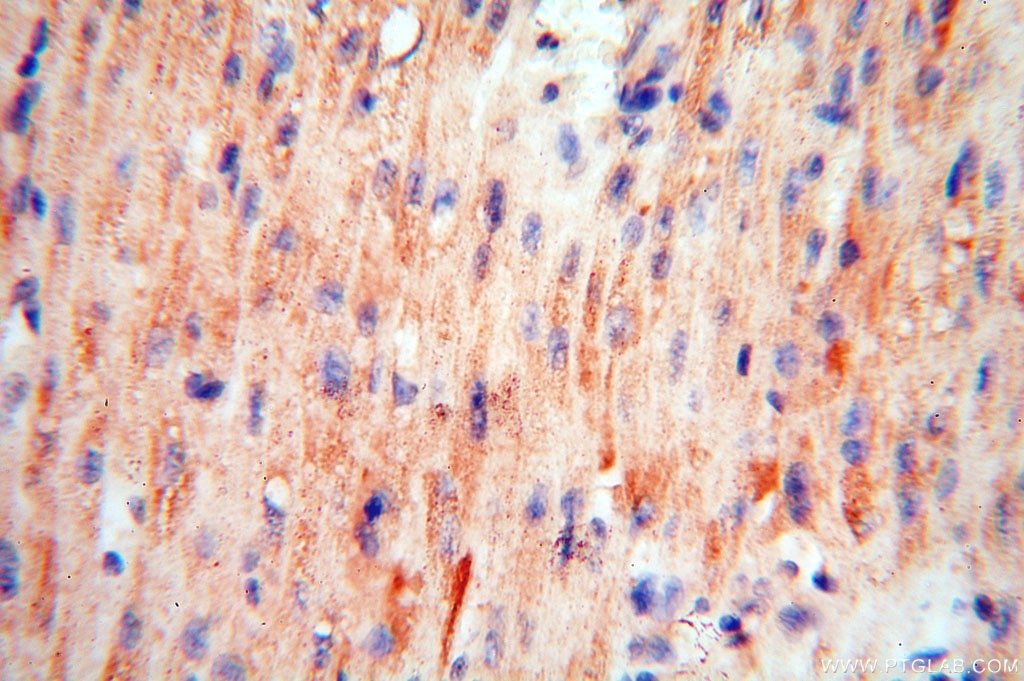 CDC37L1 IHC Immunohistochemical 16293-1-AP CDC37L1 Antibody CDC37B; FLJ20639; HARC